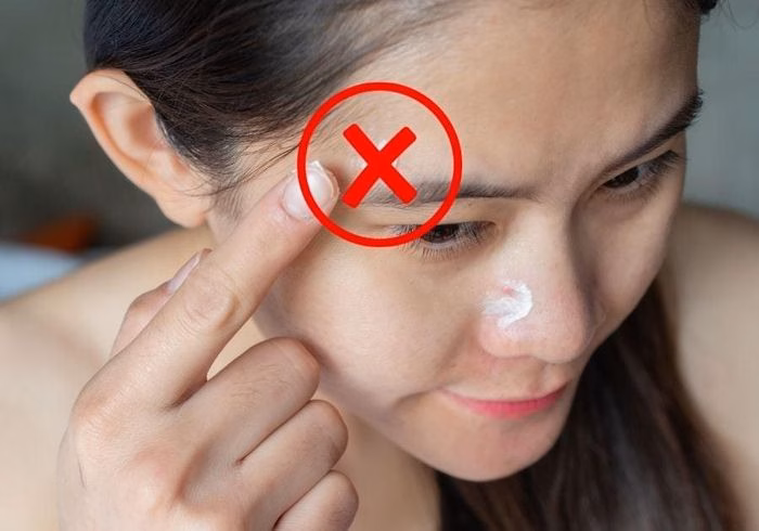 Hiện tượng white cast khiến da mặt bị trắng bệch loang lổ sau khi dùng kem chống nắng vật lý. Ảnh minh họa.